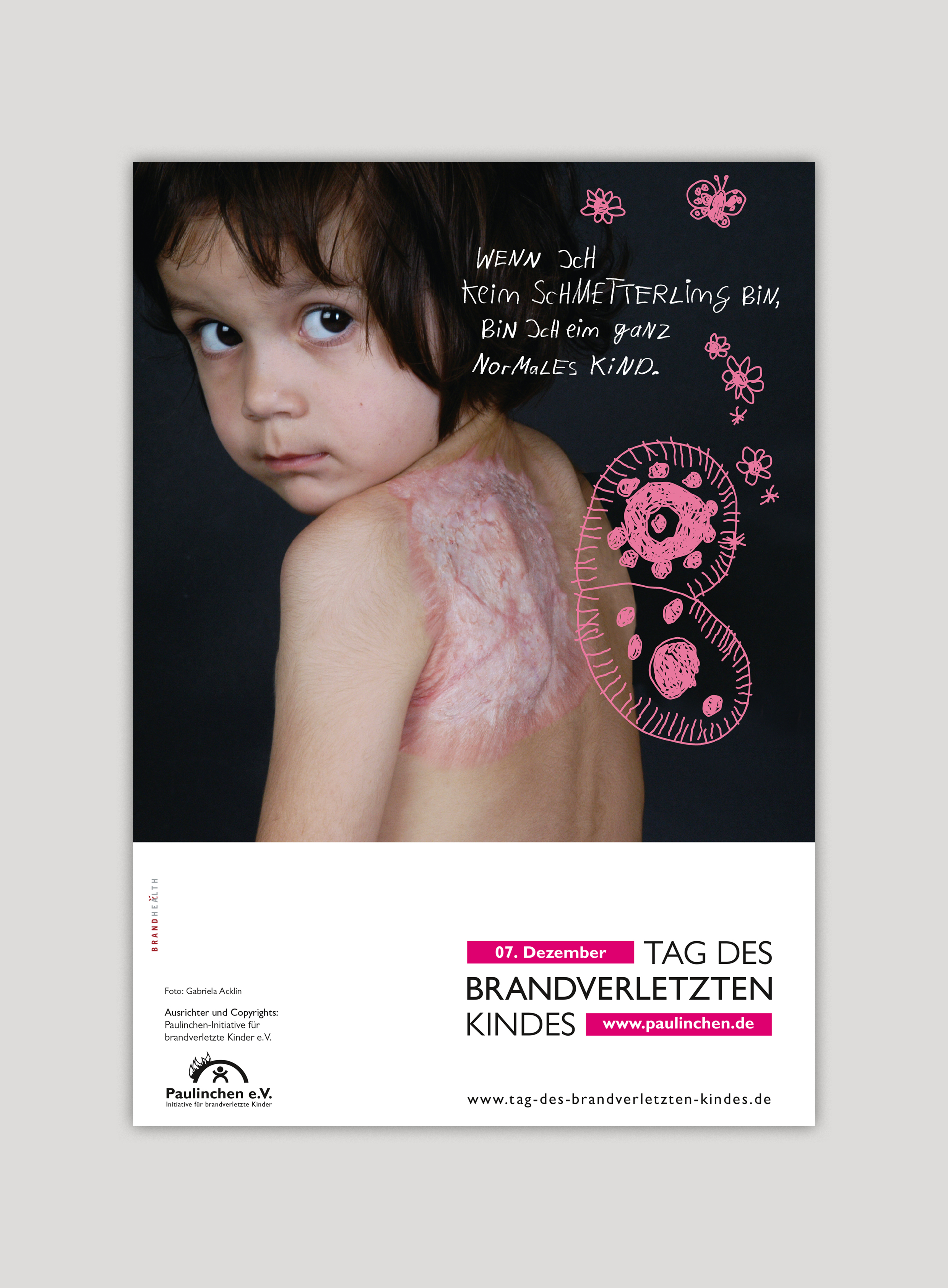 Kampagnenposter zum Tag des brandverletzten Kindes von Paulinchen e.V.